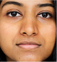 Dull & Uneven Skin